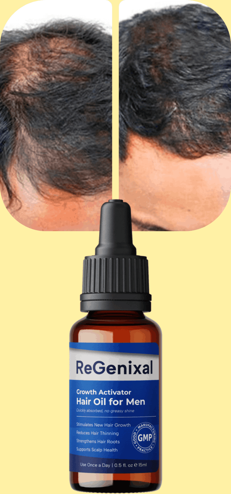 ReGenixal Hair Recover 2